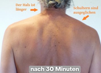 AR nachher AR nachher