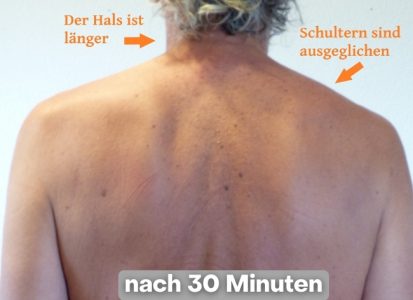 AR nachher AR nachher