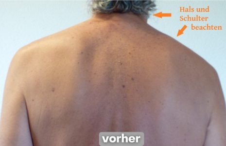 AR vorher AR vorher
