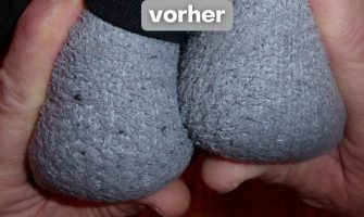 BL vorher BL vorher