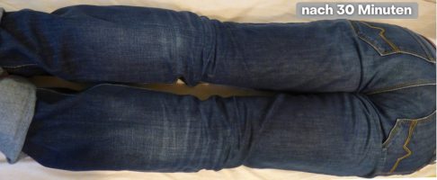 O-Beine nach 30 Minuten O-Beine nach 30 Minuten